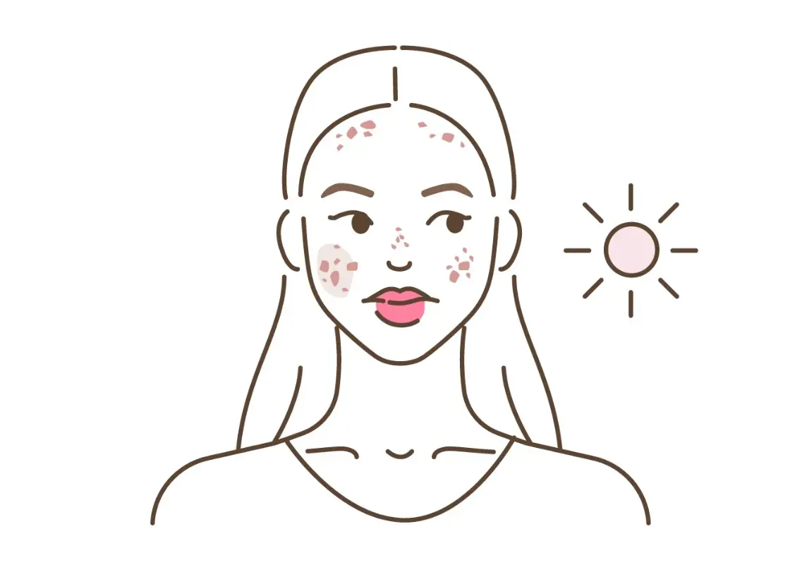 a woman outside with sensitive skin being irritated by the sun