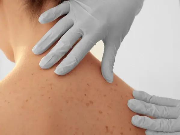 doctor examining skin